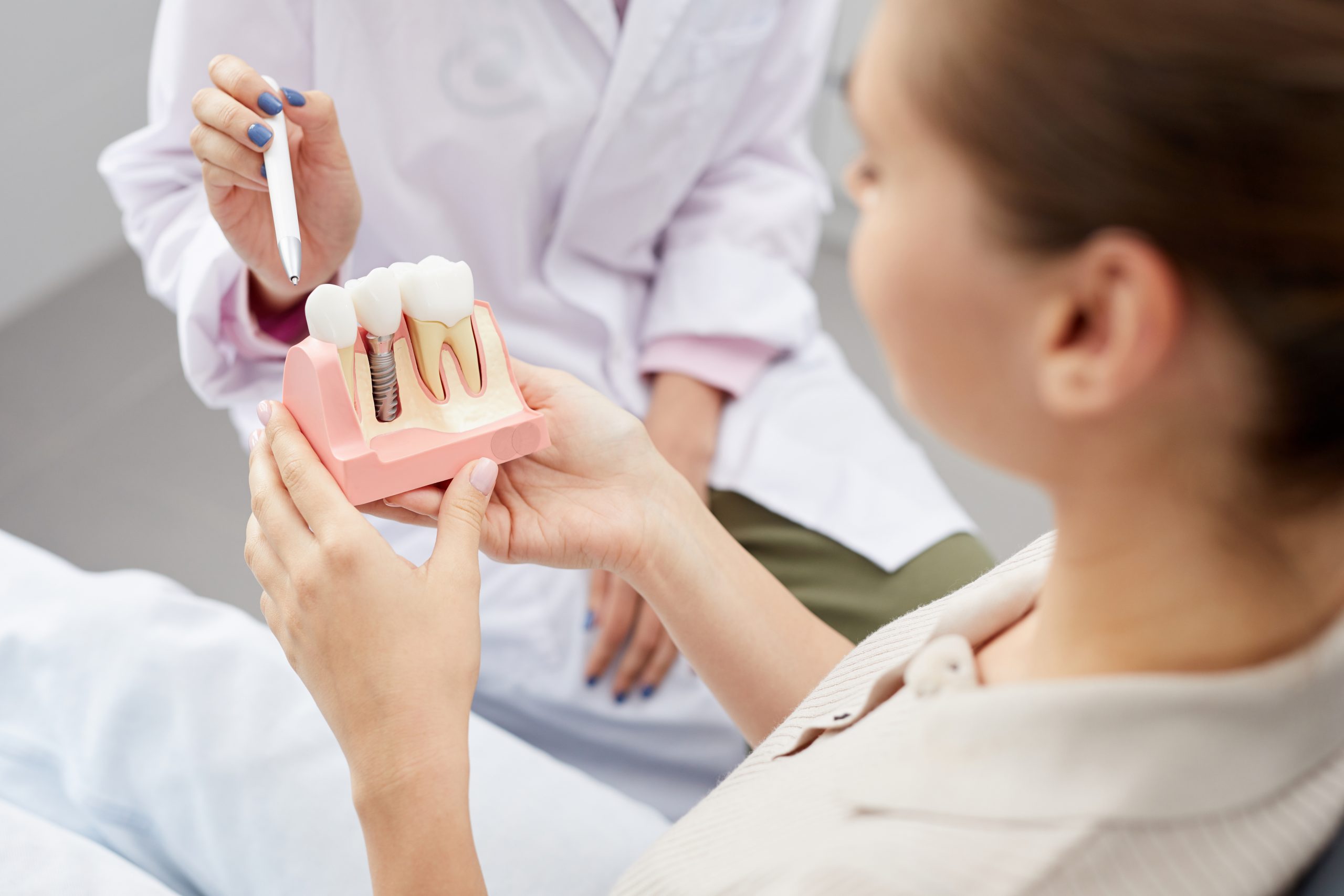 implant dentar consultatie